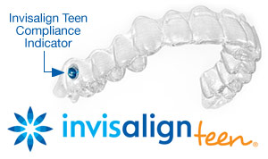 Skopek Orthodontics invisalign for teens clear aligners