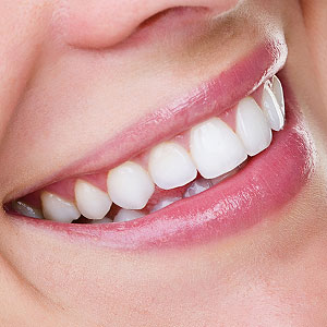 Teeth whitening services of Skopek Orthodontics